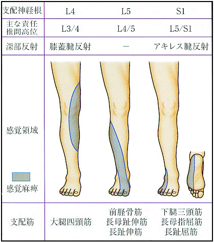 腰椎椎間板ヘルニア 榎本メディカル えのもと整骨院 鍼灸院 深江橋駅 3分 大阪市 城東区